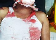 Dugaan Pengeroyokan Oknum Polisi Hingga Bersimbah Darah di Tojo Una Una